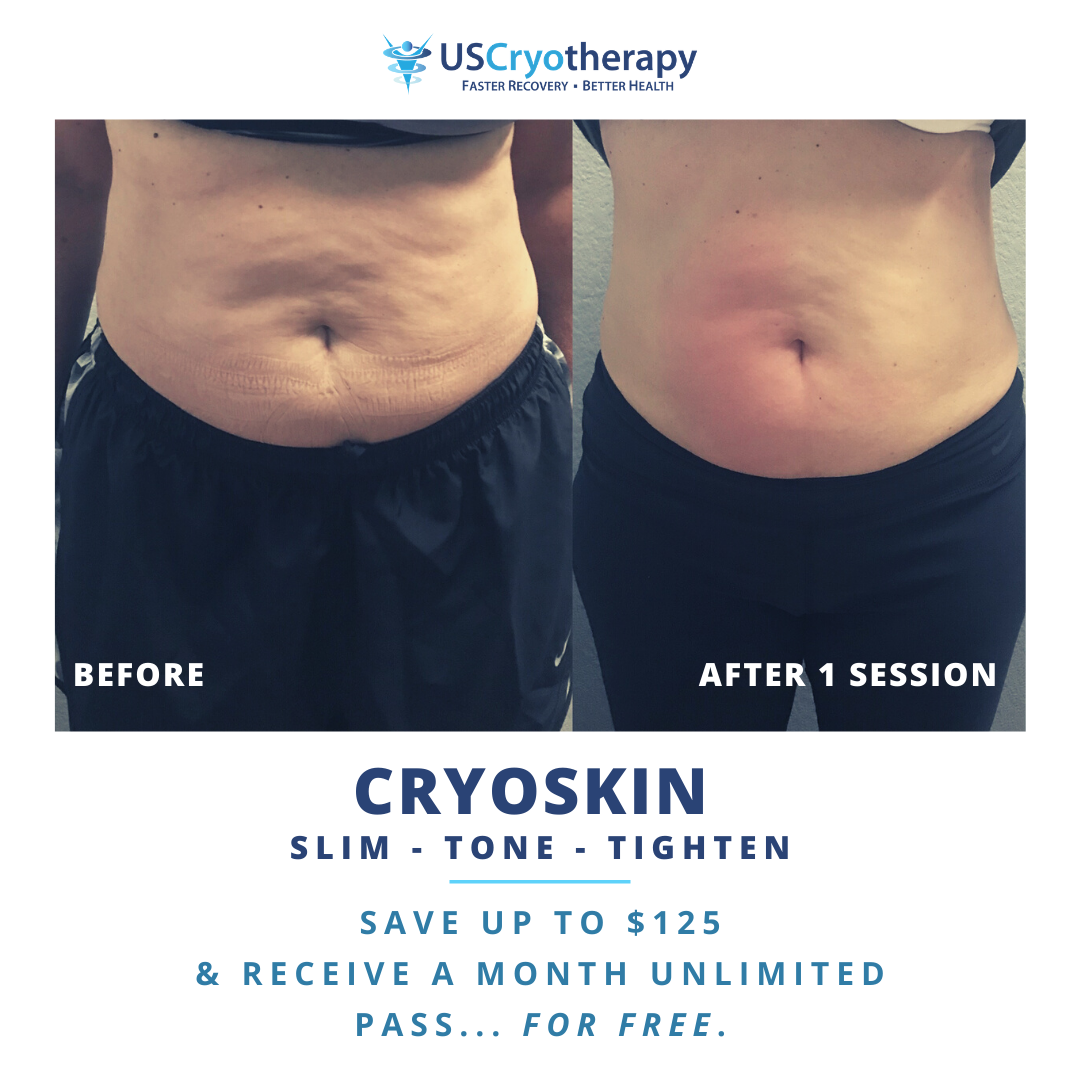 US Cryotherapy Store